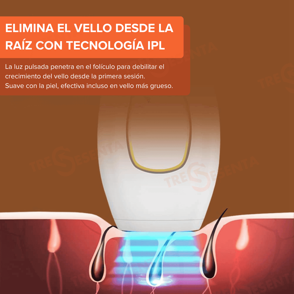 IPL Premium de Luz Pulsada