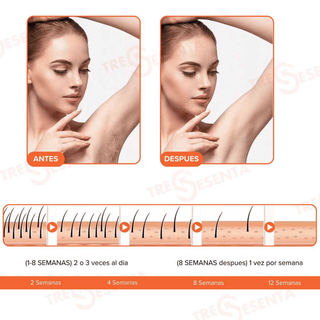 IPL Premium de Luz Pulsada