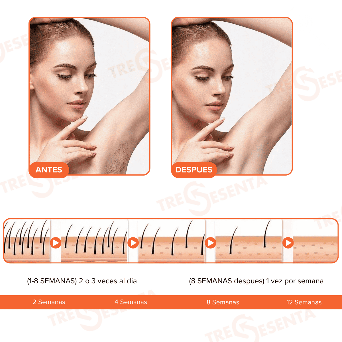 IPL Premium de Luz Pulsada